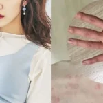 Idol-Turned-Actress Sparks Major Concern With Recent Photos