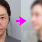 61-Year-Old Actress Shocks With New Face After Cosmetic Procedures.