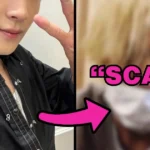 Popular Idol’s “Unrecognizable” Visuals During Live Stream Hit With Extreme Hate